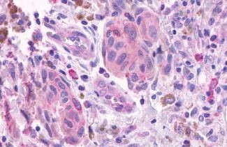 OR2A4 Antibody in Immunohistochemistry (Paraffin) (IHC (P))