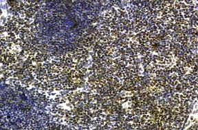 IL21R Antibody in Immunohistochemistry (IHC)