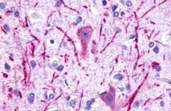 P2Y8 Antibody in Immunohistochemistry (Paraffin) (IHC (P))