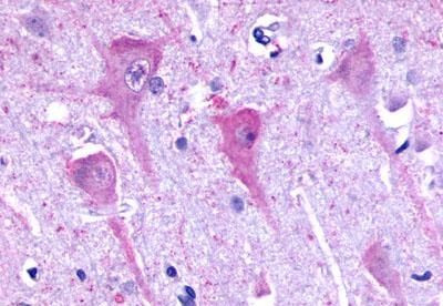 P2Y8 Antibody in Immunohistochemistry (Paraffin) (IHC (P))