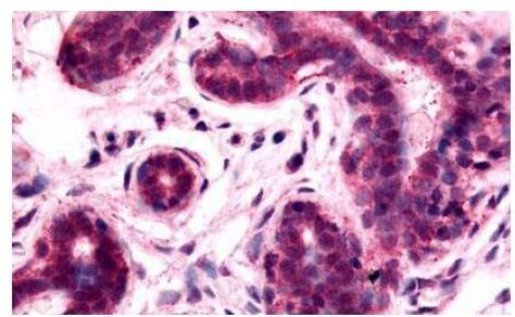 RAI3 Antibody in Immunohistochemistry (Paraffin) (IHC (P))