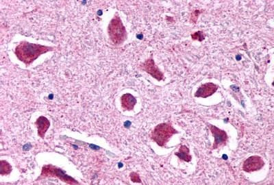 HTR2B Antibody in Immunohistochemistry (Paraffin) (IHC (P))