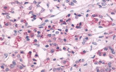 DRD1 Antibody in Immunohistochemistry (Paraffin) (IHC (P))