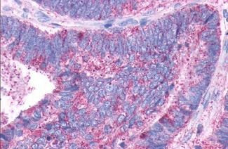 DRD1 Antibody in Immunohistochemistry (Paraffin) (IHC (P))