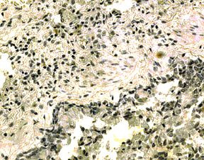 IL21R Antibody in Immunohistochemistry (IHC)