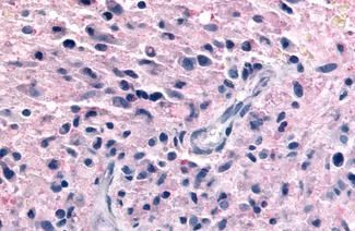 P2Y12 Antibody in Immunohistochemistry (Paraffin) (IHC (P))