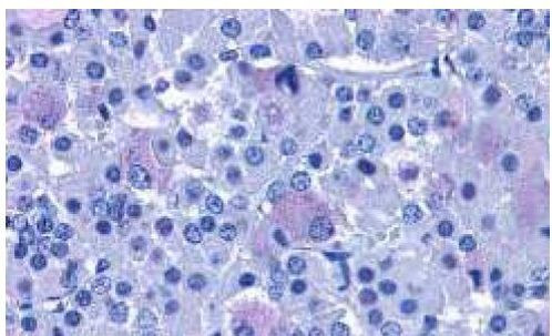 PACAP Receptor Antibody in Immunohistochemistry (Paraffin) (IHC (P))