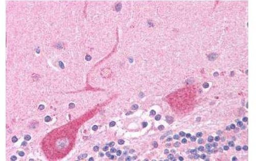 NEK6 Antibody in Immunohistochemistry (Paraffin) (IHC (P))