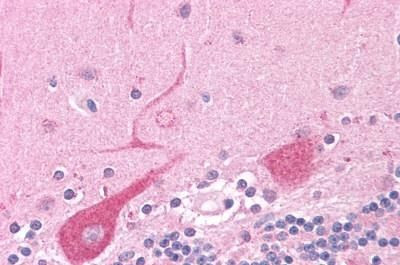 NEK6 Antibody in Immunohistochemistry (Paraffin) (IHC (P))