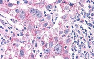 NEK6 Antibody in Immunohistochemistry (Paraffin) (IHC (P))