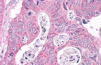 NEK6 Antibody in Immunohistochemistry (Paraffin) (IHC (P))