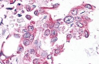 NEK6 Antibody in Immunohistochemistry (Paraffin) (IHC (P))