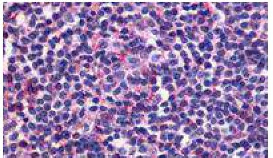 EDG6 Antibody in Immunohistochemistry (Paraffin) (IHC (P))