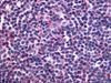 EDG6 Antibody in Immunohistochemistry (Paraffin) (IHC (P))