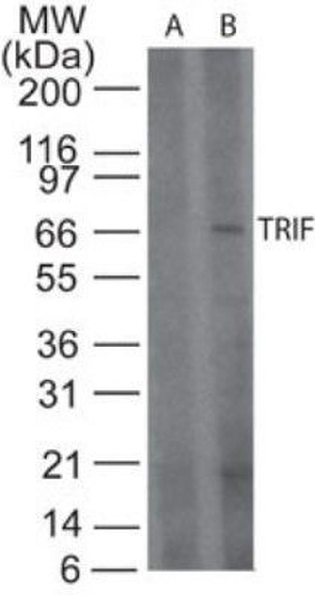 TRIF Antibody in Western Blot (WB)