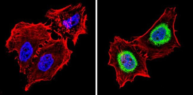 THRA Antibody in Immunocytochemistry (ICC/IF)