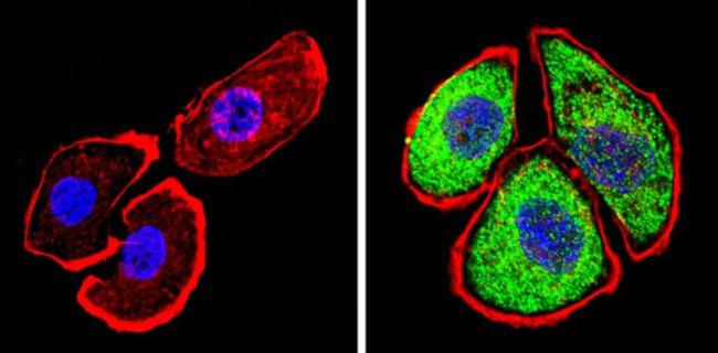 THRA Antibody in Immunocytochemistry (ICC/IF)