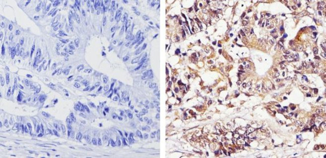 THRA Antibody in Immunohistochemistry (Paraffin) (IHC (P))