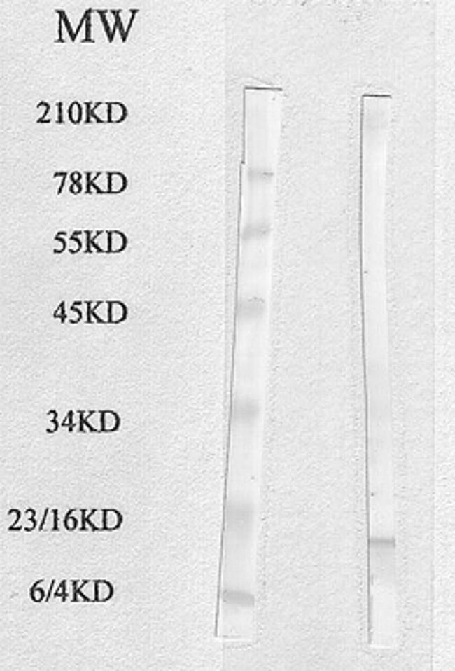 FABP4 Antibody in Western Blot (WB)