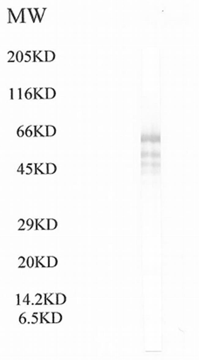 BRWD1 Antibody in Western Blot (WB)