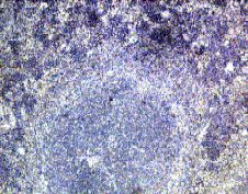 IFNLR1 Antibody in Immunohistochemistry (Paraffin) (IHC (P))