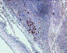 IL-22 Receptor alpha Antibody in Immunohistochemistry (IHC)