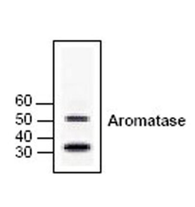 Aromatase Antibody in Western Blot (WB)