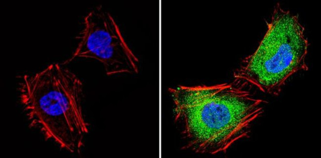 THRB Antibody in Immunocytochemistry (ICC/IF)