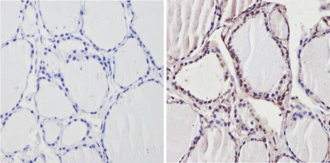 THRB Antibody in Immunohistochemistry (Paraffin) (IHC (P))