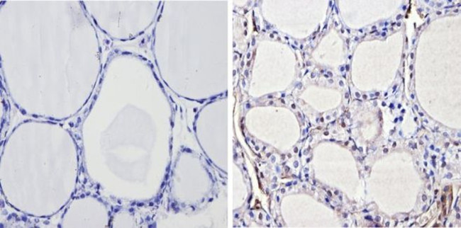 THRB Antibody in Immunohistochemistry (Paraffin) (IHC (P))