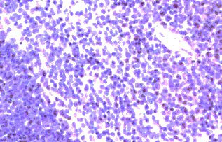 CCR9 Antibody in Immunohistochemistry (Paraffin) (IHC (P))