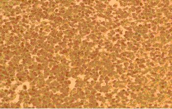 CCR3 Antibody in Immunocytochemistry (ICC/IF)