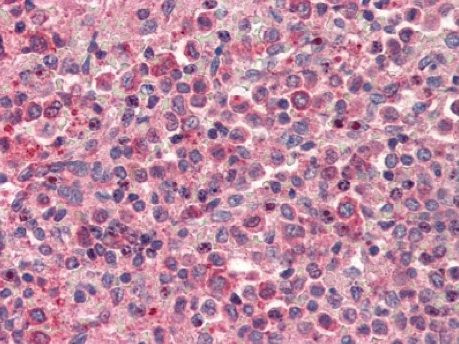 CXCR4 Antibody in Immunohistochemistry (IHC)