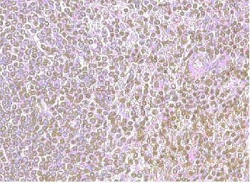 CXCR4 Antibody in Immunohistochemistry (Paraffin) (IHC (P))