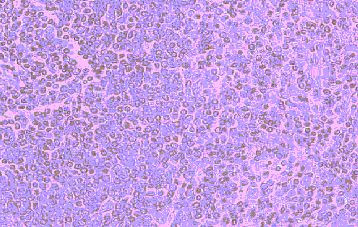 CCR5 Antibody in Immunohistochemistry (Paraffin) (IHC (P))