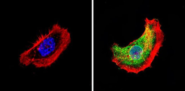 THRA Antibody in Immunocytochemistry (ICC/IF)