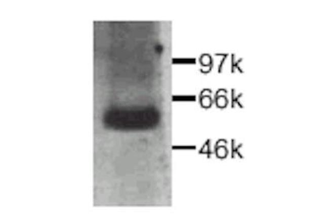 CTGF Antibody in Western Blot (WB)