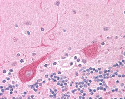 E6AP Antibody in Immunohistochemistry (IHC)