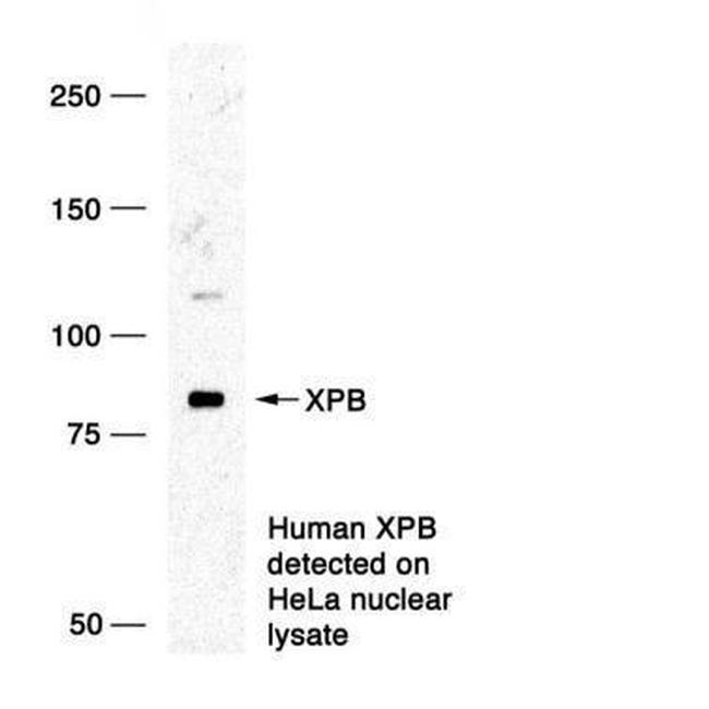 XPB Antibody in Western Blot (WB)