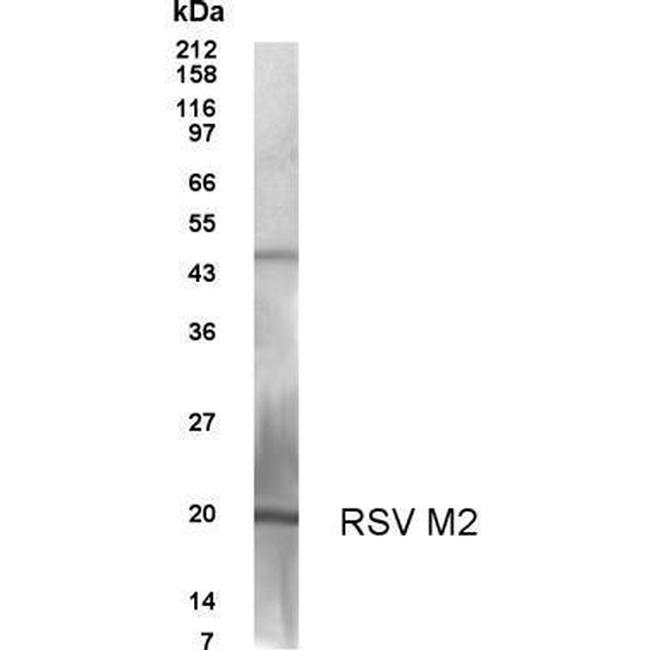 RSV M2 Antibody in Western Blot (WB)