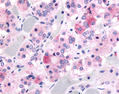 Kallikrein 9 Antibody in Immunohistochemistry (IHC)