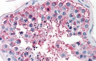 FSHR Antibody in Immunohistochemistry (Paraffin) (IHC (P))