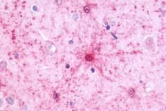 NMBR Antibody in Immunohistochemistry (Paraffin) (IHC (P))