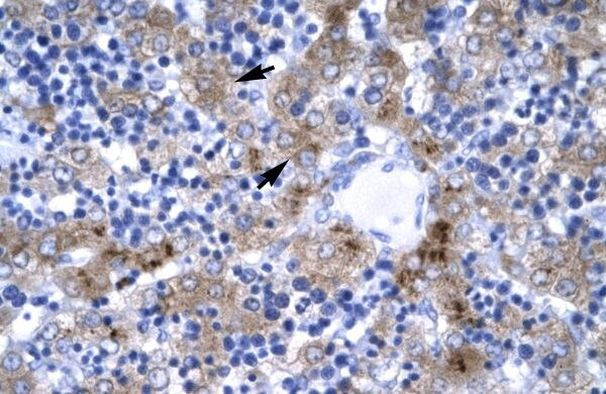 IRF9 Antibody in Immunohistochemistry (Paraffin) (IHC (P))