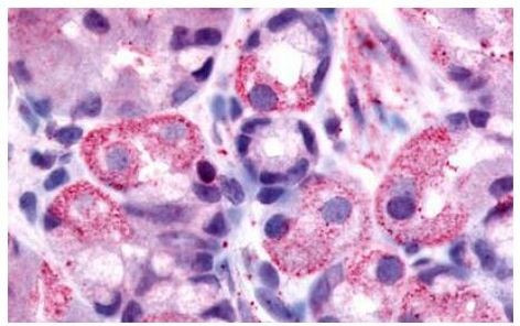 HRH2 Antibody in Immunohistochemistry (Paraffin) (IHC (P))