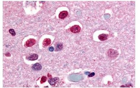 NOR-1 Antibody in Immunohistochemistry (Paraffin) (IHC (P))