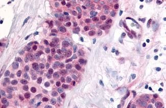 TLX Antibody in Immunohistochemistry (Paraffin) (IHC (P))