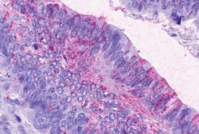 CCKAR Antibody in Immunohistochemistry (Paraffin) (IHC (P))