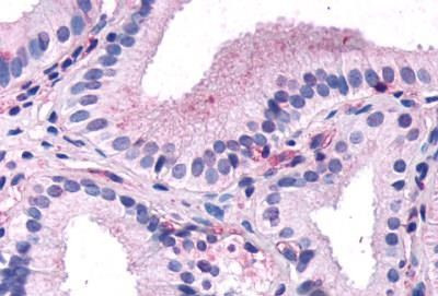 CCKAR Antibody in Immunohistochemistry (Paraffin) (IHC (P))