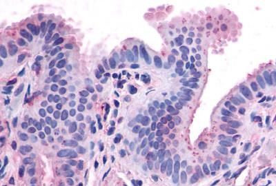 CCKAR Antibody in Immunohistochemistry (Paraffin) (IHC (P))